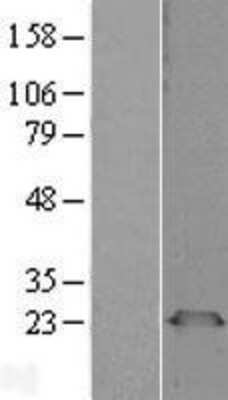 Western Blot: PGRMC1 Overexpression Lysate (Adult Normal) [NBL1-14341] Left-Empty vector transfected control cell lysate (HEK293 cell lysate); Right -Over-expression Lysate for PGRMC1.