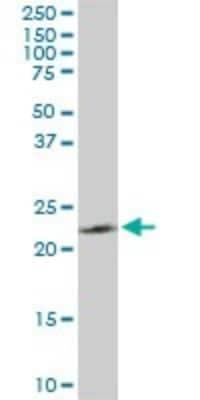 Western Blot: PGRMC2 Antibody (3C11) [H00010424-M04] - Analysis of PGRMC2 expression in PC-12 (Cat # L012V1).