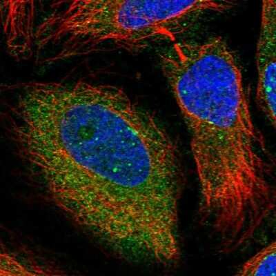 Immunocytochemistry/Immunofluorescence: PGRMC2 Antibody [NBP2-13753] - Staining of human cell line HeLa shows positivity in nuclear membrane and cytoplasm.