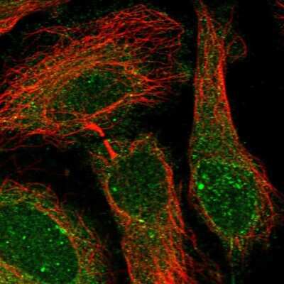 <b>Independent Antibodies Validation. </b>Immunocytochemistry/Immunofluorescence: PGRMC2 Antibody [NBP2-13753] - Staining of human cell line HeLa shows localization to nuclear bodies, nuclear membrane & cytosol.