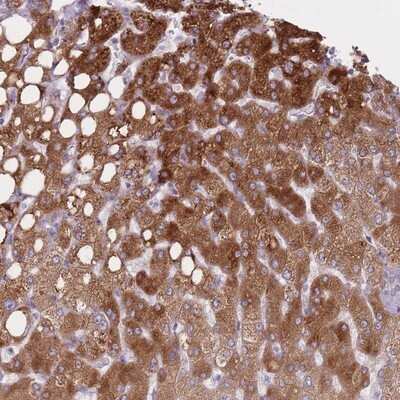 Immunohistochemistry-Paraffin: PGRMC2 Antibody [NBP2-13753] - Staining of human liver shows strong cytoplasmic positivity in hepatocytes .