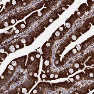 <b>Independent Antibodies Validation. </b>Immunohistochemistry-Paraffin: PGRMC2 Antibody [NBP2-49289] - Staining of human small intestine shows strong cytoplasmic positivity in glandular cells.