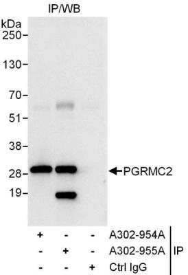 Immunoprecipitation: PGRMC2 Antibody [NBP1-49716] - Samples:  Whole cell lysate (1 mg for IP, 20% of IP loaded) from HeLa cells.  Antibodies: Affinity purified rabbit anti-PGRMC2 antibody NBP1-49716 used for IP at 3 ug/mg lysate.  PGRMC2 was also immunoprecipitated by rabbit anti-PGRMC2 antibody NBP1-49895, which recognizes a downstream epitope.  For blotting immunoprecipitated PGRMC2, NBP1-49895 was used at 1 ug/ml.  Detection: Chemiluminescence with an exposure time of 10 seconds.