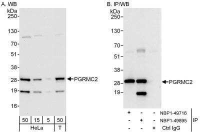 Western Blot: PGRMC2 Antibody [NBP1-49895] - Samples: Whole cell lysate from HeLa (5, 15 and 50 ug for WB; 1 mg for IP, 20% of IP loaded) and 293T (T; 50 ug) cells.  Antibodies: Affinity purified rabbit anti-PGRMC2 antibody NBP1-49895 used for WB at 0.04 ug/ml (A) and 1 ug/ml (B) and used for IP at 3 ug/mg lysate.  PGRMC2 was also immunoprecipitated by rabbit anti-PGRMC2 antibody NBP1-49716, which recognizes an upstream epitope.  Detection: Chemiluminescence with exposure times of 10 seconds (A and B).