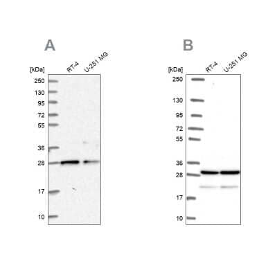 Western Blot: PGRMC2 Antibody [NBP2-13753] - Analysis using Anti-PGRMC2 antibody NBP2-13753 (A) shows similar pattern to independent antibody NBP2-49289 (B).