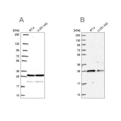 Western Blot: PGRMC2 Antibody [NBP2-49289] - Analysis using Anti-PGRMC2 antibody NBP2-49289 (A) shows similar pattern to independent antibody NBP2-13753 (B).