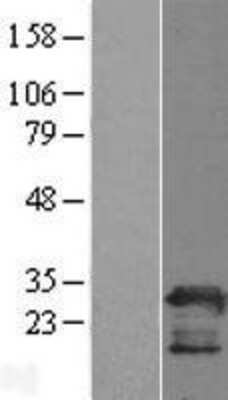 Western Blot: PGRMC2 Overexpression Lysate (Adult Normal) [NBL1-14342] Left-Empty vector transfected control cell lysate (HEK293 cell lysate); Right -Over-expression Lysate for PGRMC2.