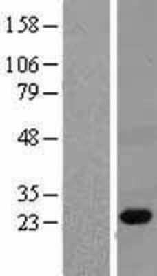 Western Blot: PGRP Overexpression Lysate (Adult Normal) [NBL1-14334] Left-Empty vector transfected control cell lysate (HEK293 cell lysate); Right -Over-expression Lysate for PGRP.