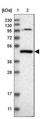 Western Blot: PGLYRP3/PGRPIA Antibody [NBP1-80919] - PGRP1A Antibody [NBP1-80919] - Lane 1: Marker  [kDa] 230, 130, 95, 72, 56, 36, 28, 17, 11.  Lane 2: Human cell line RT-4.