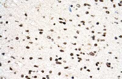 Immunohistochemistry: PGS1 Antibody [NBP2-88040] - Human Brain