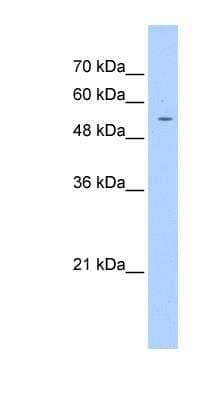 Western Blot: PGS1 Antibody [NBP1-52834] - Jurkat cell lysate, concentration 1.25ug/ml.