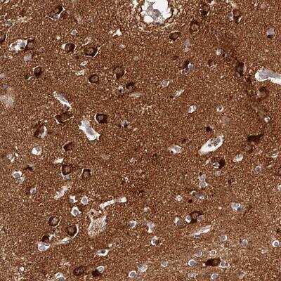 Immunohistochemistry-Paraffin PHACTR1 Antibody - BSA Free