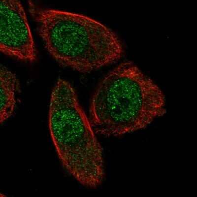 Immunocytochemistry/Immunofluorescence: PHACTR3 Antibody [NBP2-55045] - Staining of human cell line PC-3 shows localization to nucleoplasm. Antibody staining is shown in green.