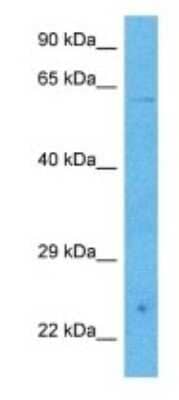 Western Blot: PHACTR3 Antibody [NBP3-09933] - Western blot analysis of PHACTR3 in Human 786-0 Whole Cell. Antibody dilution at 1 ug/mL