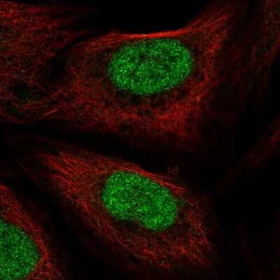 Immunocytochemistry/ Immunofluorescence PHAX Antibody - BSA Free