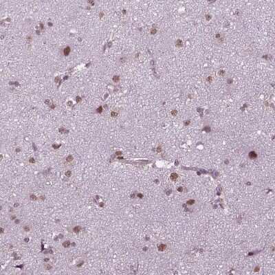 Immunohistochemistry: PHAX Antibody [NBP2-48821] - Staining of human cerebral cortex shows moderate nuclear positivity in neuronal cells and glial cells.