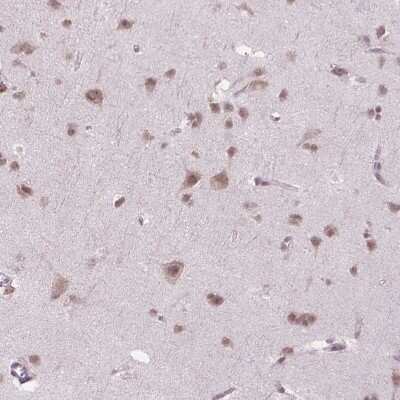 Immunohistochemistry-Paraffin PHAX Antibody