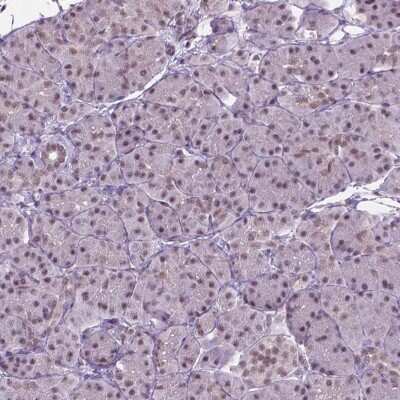 Immunohistochemistry-Paraffin PHAX Antibody