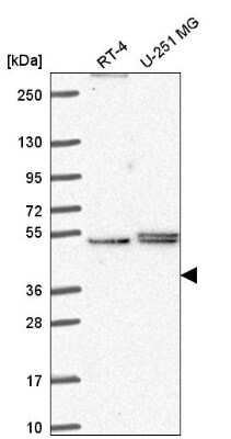 Western Blot PHAX Antibody - BSA Free