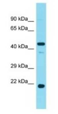 Western Blot: PHAX Antibody [NBP3-09461] - Western blot analysis of PHAX in Human Fetal Liver. Antibody dilution at 1ug/ml