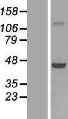 Western Blot: PHAX Overexpression Lysate (Adult Normal) [NBL1-15472] Left-Empty vector transfected control cell lysate (HEK293 cell lysate); Right -Over-expression Lysate for PHAX.
