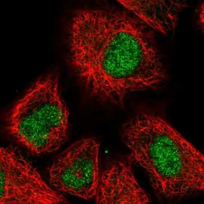 Immunocytochemistry/Immunofluorescence: PHC3 Antibody [NBP2-56214] - Staining of human cell line A549 shows localization to nucleus.