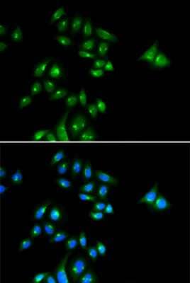 Immunocytochemistry/Immunofluorescence: PHC3 Antibody [NBP3-04368] - Analysis of U2OS cells using PHC3 antibody . Blue: DAPI for nuclear staining.