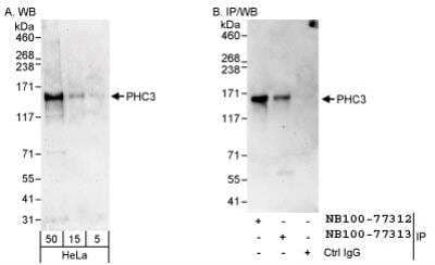 <b>Independent Antibodies Validation. </b>Western Blot: PHC3 Antibody [NB100-77312] - Detection of Human PHC3 by Western Blot and Immunoprecipitation.  Samples: Whole cell lysate (5, 15 and 50 mcg for WB; 1 mg for IP, 20% of IP loaded) from HeLa cells.  Antibodies: Affinity purified rabbit anti-PHC3 antibody NB100-77312 used for WB at 0.1 mcg/ml (A) and 1 mcg/ml (B) and used for IP at 3 mcg/mg lysate.  PHC3 was also immunoprecipitated by another rabbit anti-PHC3 antibody, which recognizes a downstream epitope.