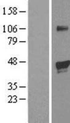 Western Blot EGLN2/PHD1 Overexpression Lysate