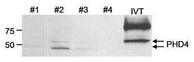 Western Blot PHD4/HIF Prolyl Hydroxylase 4 Antibody