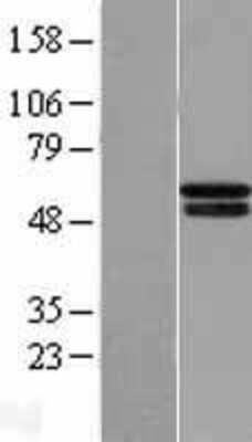 Western Blot PHD4/HIF Prolyl Hydroxylase 4 Overexpression Lysate