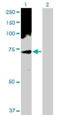 Western Blot: PHF1 Antibody [H00005252-D01P] - Analysis of PHF1 expression in transfected 293T cell line by PHF1 polyclonal antibody.Lane 1: PHF1 transfected lysate(62.10 KDa).Lane 2: Non-transfected lysate.