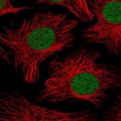 Immunocytochemistry/Immunofluorescence: PHF10 Antibody [NBP2-33759] - Immunofluorescent staining of human cell line HeLa shows localization to nucleus.