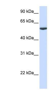 Western Blot: PHF10 Antibody [NBP1-52879] - Human Lung lysate, concentration 0.2-1 ug/ml.