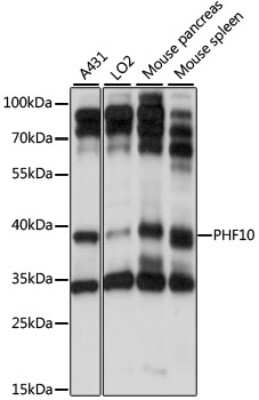 Western Blot: PHF10 Antibody [NBP2-94819] - Analysis of extracts of various cell lines, using PHF10 at 1:1000 dilution. Secondary antibody: HRP Goat Anti-Rabbit IgG (H+L) at 1:10000 dilution. Lysates/proteins: 25ug per lane. Blocking buffer: 3% nonfat dry milk in TBST. Detection: ECL Basic Kit . Exposure time: 10s.