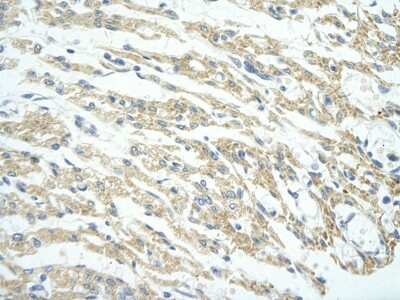 Immunohistochemistry: PHF11 Antibody [NBP1-80054] - Human Heart cell Cellular data: cardiac cell Antibody Concentration: 4.0-8.0 ug/ml Magnification: 400X.