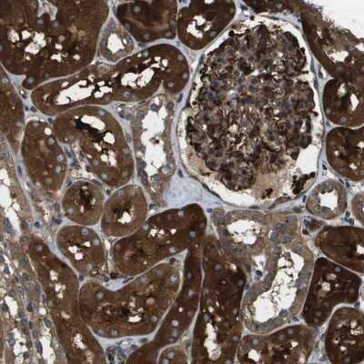 Immunohistochemistry-Paraffin: PHF11 Antibody [NBP1-88684] - Staining of human kidney shows strong positivity in tubules as well as glomeruli.