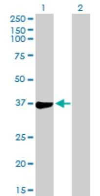 Western Blot: PHF11 Antibody [H00051131-B01P] - Analysis of PHF11 expression in transfected 293T cell line by PHF11 polyclonal antibody.  Lane 1: PHF11 transfected lysate(32.12 KDa). Lane 2: Non-transfected lysate.