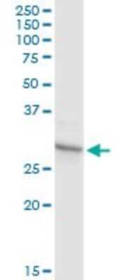 Western Blot: PHF11 Antibody [H00051131-D01P] - Analysis of PHF11 expression in mouse spleen.