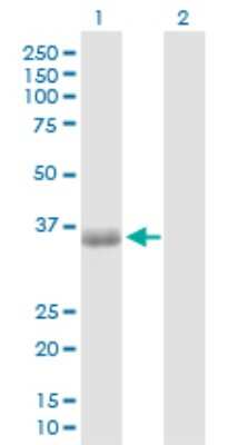 Western Blot: PHF11 Antibody [H00051131-D01P] - Analysis of PHF11 expression in transfected 293T cell line by PHF11 polyclonal antibody.Lane 1: PHF11 transfected lysate(33.50 KDa).Lane 2: Non-transfected lysate.