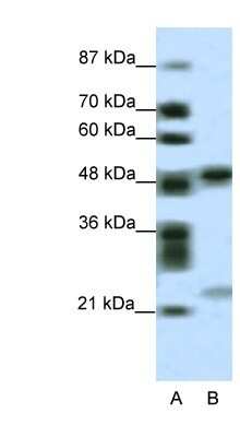 Western Blot: PHF11 Antibody [NBP1-80054] - HepG2 cell lysate, concentration 0.2-1 ug/ml.
