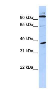 Western Blot: PHF11 Antibody [NBP1-80332] - Titration: 0.2-1 ug/ml, Positive Control: MCF7 cell lysate.