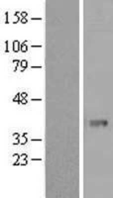 Western Blot PHF11 Overexpression Lysate