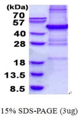 SDS-PAGE Recombinant Human PHF11 His Protein