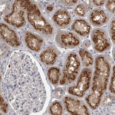 Immunohistochemistry-Paraffin: PHF13 Antibody [NBP1-81077] - Staining of human kidney shows strong membranous positivity in tubule cells.