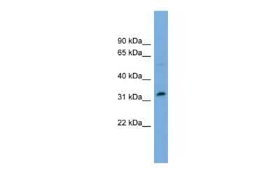 Western Blot: PHF13 Antibody [NBP2-83388] - WB Suggested Anti-PHF13 Antibody Titration: 0.2-1 ug/ml. Positive Control: OVCAR-3 cell lysate