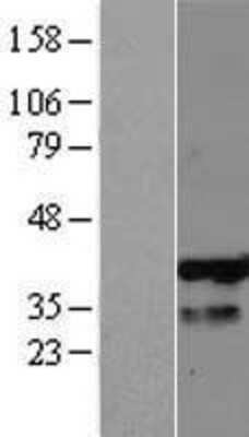 Western Blot PHF13 Overexpression Lysate
