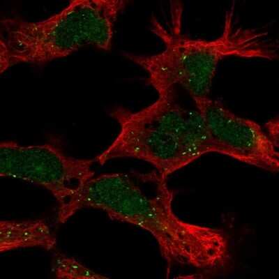 Immunocytochemistry/ Immunofluorescence PHF14 Antibody