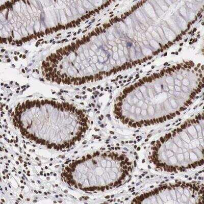 Immunohistochemistry-Paraffin PHF14 Antibody