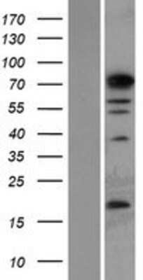 Western Blot PHF14 Overexpression Lysate